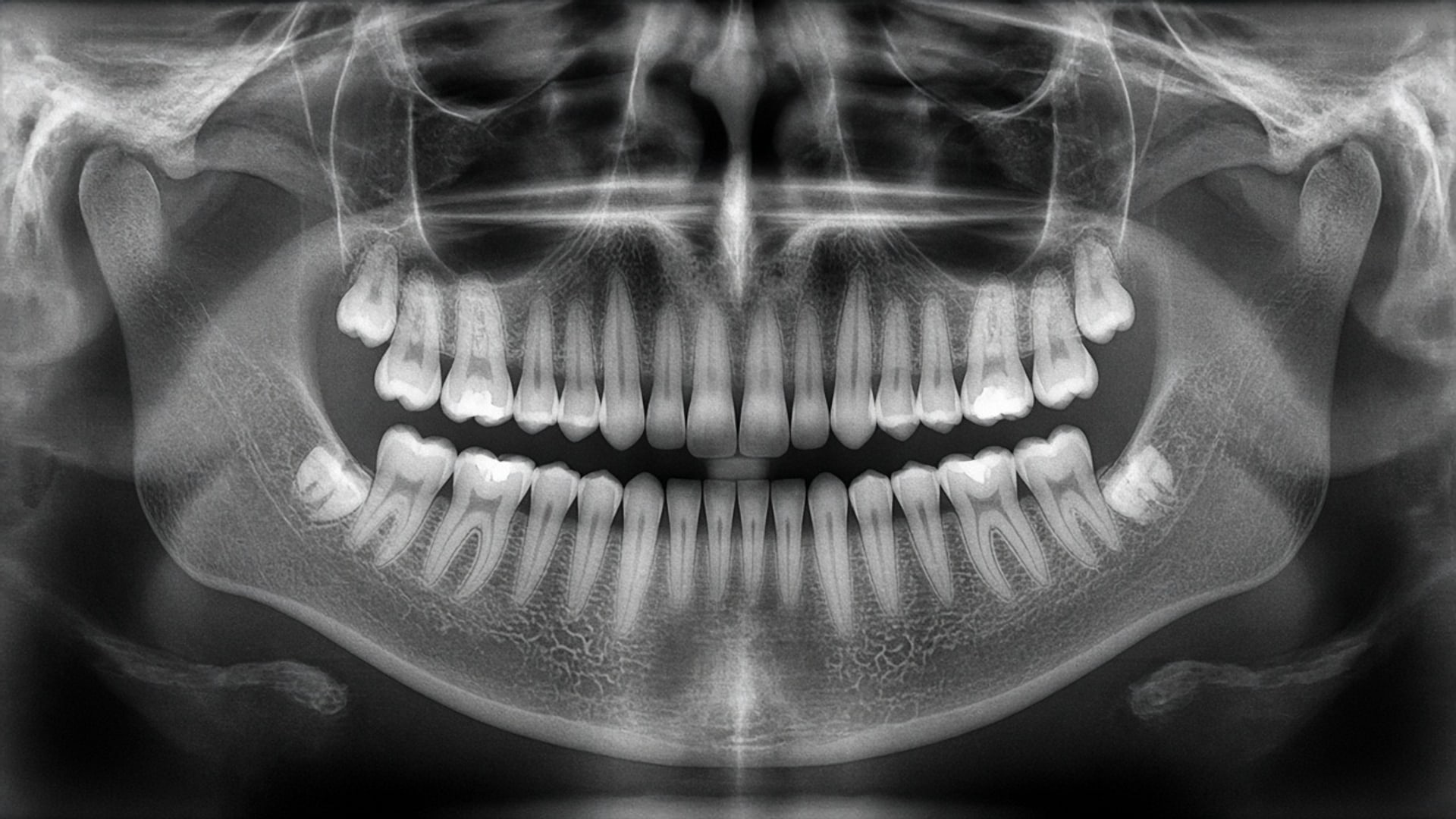 Digital dental X-ray at Lawrence Park Dentistry